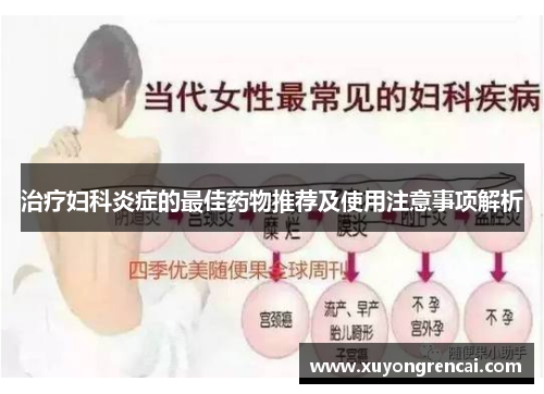 治疗妇科炎症的最佳药物推荐及使用注意事项解析